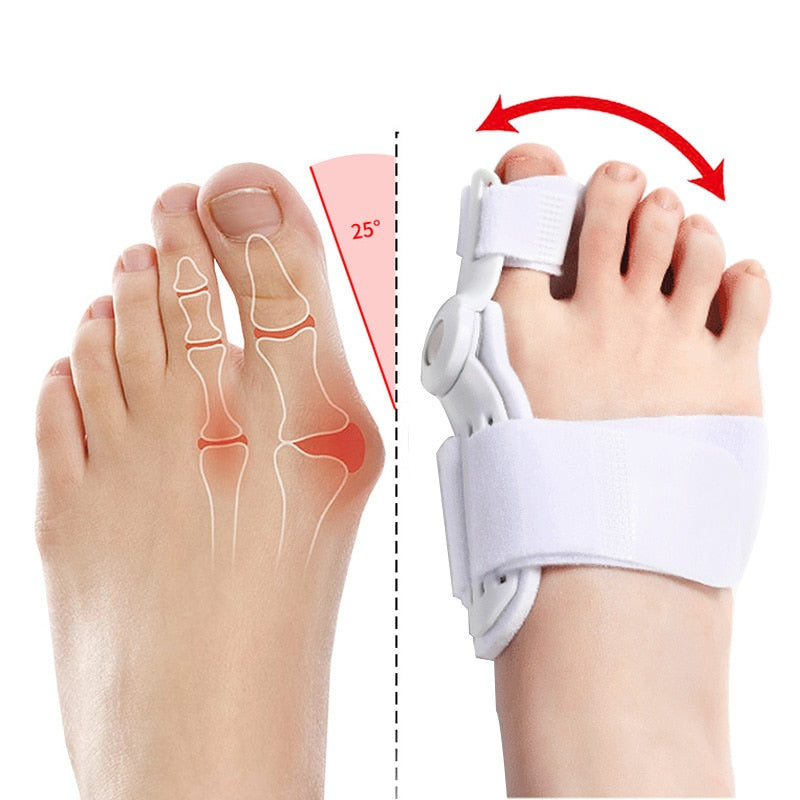 2Pcs Hallux Valgus | Corrector Juanetes Para Dedos | Free Shipping