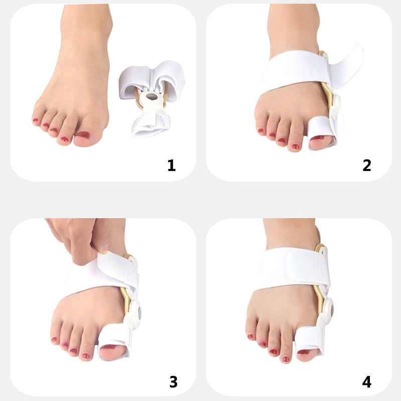 2Pcs Hallux Valgus | Corrector Juanetes Para Dedos | Free Shipping