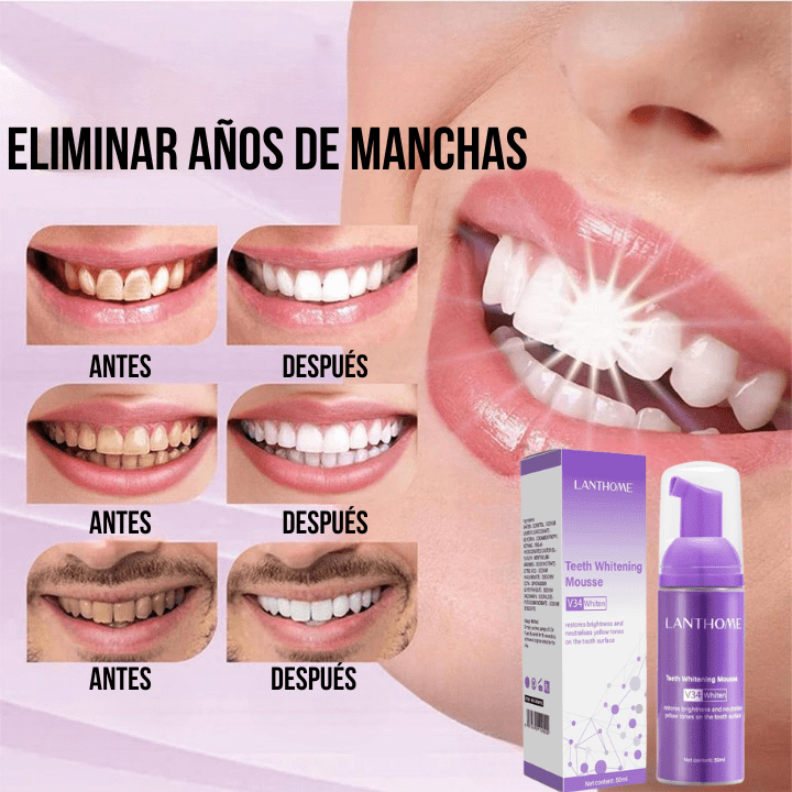 Blanqueamiento dental lanthome fresh white | [RESULTADO PROBADO]